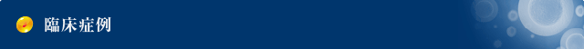 セルチャーの臨床症例臨床症例