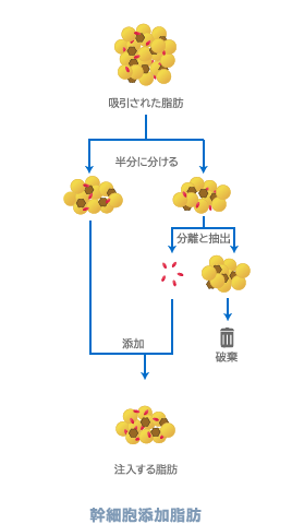 脂肪幹細胞注入のプロセス
