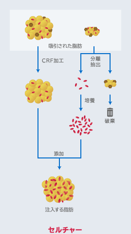 セルチャー注入のプロセス