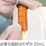 採取する脂肪量はごくわずか