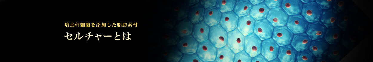 セルチャーとは