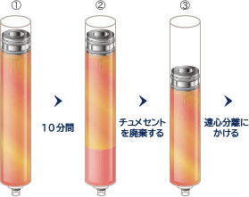 シリンジを10分間立てておくと、脂肪とチュメセント液（麻酔液）とに分離するので、チュメセントを廃棄