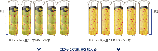 注入脂肪の比較1