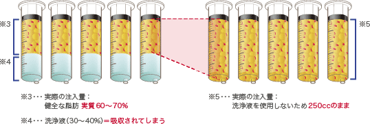 注入脂肪の比較2