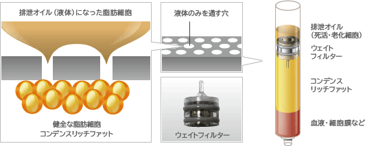 ウェイトフィルターは、、排泄オイルになった液体と残った健全な脂肪細胞をしっかり分離させることができます