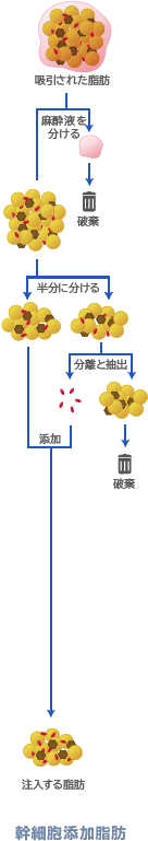 脂肪幹細胞注入のプロセス