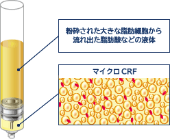 限りなく良質で滑らかな脂肪（マイクロCRF）を抽出することができる